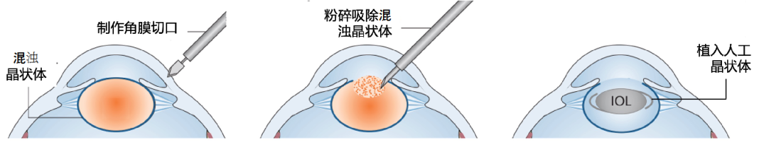 b3d8ad1a-37ba-4807-b4c7-fdf7a2d463d5.png